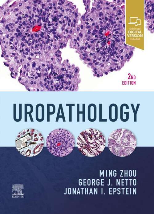 Book cover of Uropathology E-Book: A Volume In The High Yield Pathology Series (2) (High Yield Pathology Ser.)