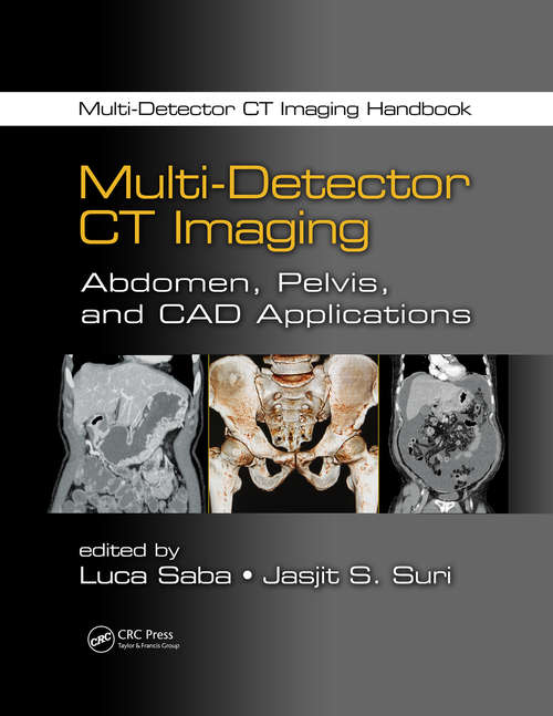 Book cover of Multi-Detector CT Imaging: Abdomen, Pelvis, and CAD Applications