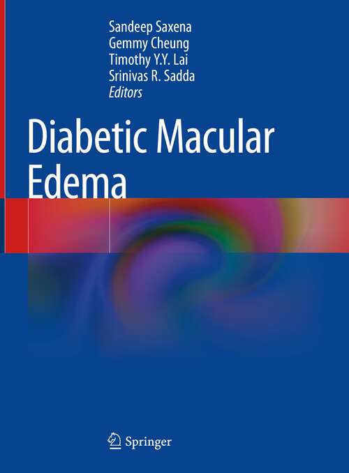 Book cover of Diabetic Macular Edema (1st ed. 2022)