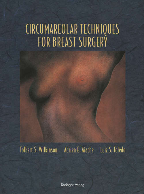 Book cover of Circumareolar Techniques for Breast Surgery (1995)