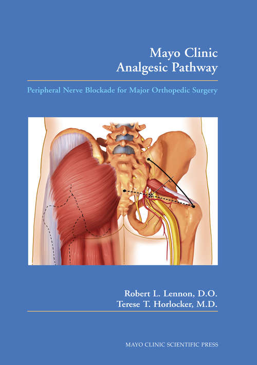 Book cover of Mayo Clinic Analgesic Pathway: Peripheral Nerve Blockade for Major Orthopedic Surgery and Procedural Training Manual