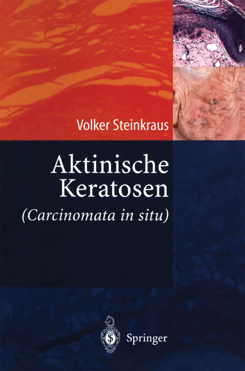 Book cover of Aktinische Keratosen (Carcinomata in situ) (2004)