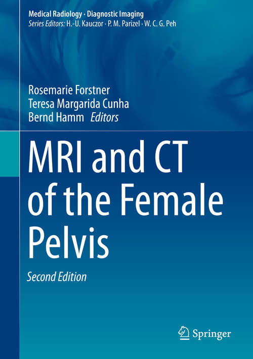 Book cover of MRI and CT of the Female Pelvis (Medical Radiology)