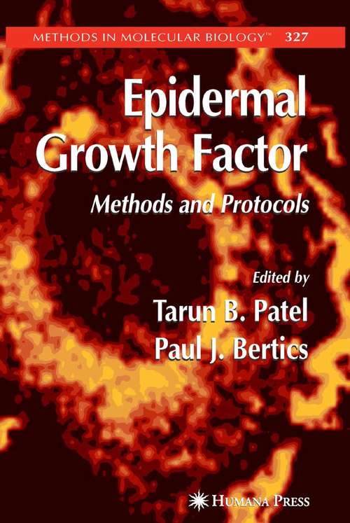 Book cover of Epidermal Growth Factor: Methods and Protocols (2006) (Methods in Molecular Biology #327)