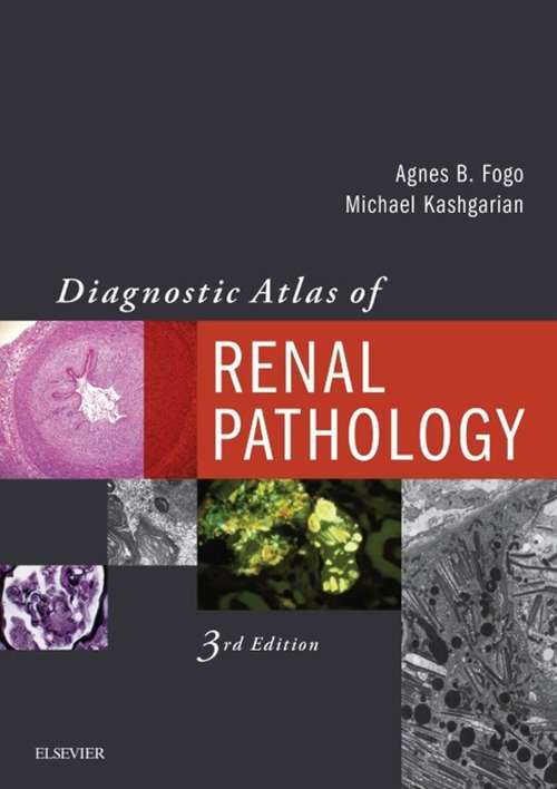 Book cover of Diagnostic Atlas of Renal Pathology E-Book: A Companion To Brenner And Rector's The "kidney" (3)