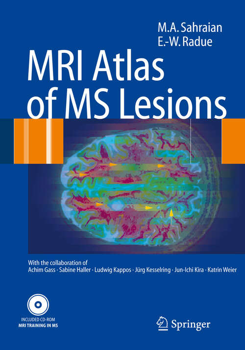 Book cover of MRI Atlas of MS Lesions (2008)