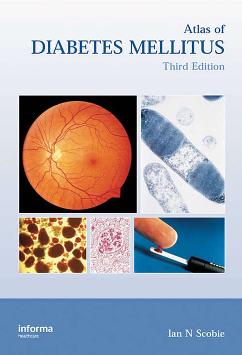 Book cover of Atlas of Diabetes Mellitus (3)