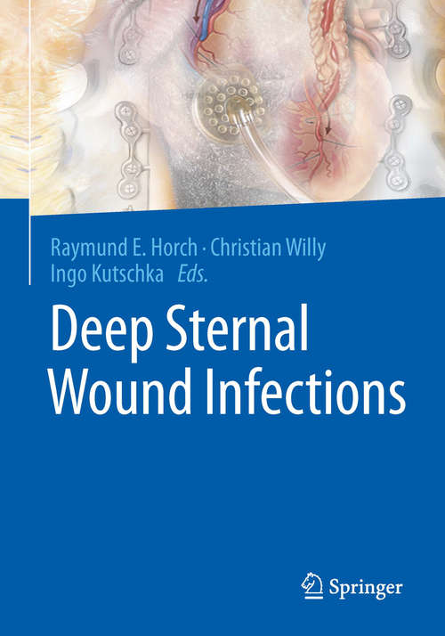 Book cover of Deep Sternal Wound Infections (1st ed. 2016)