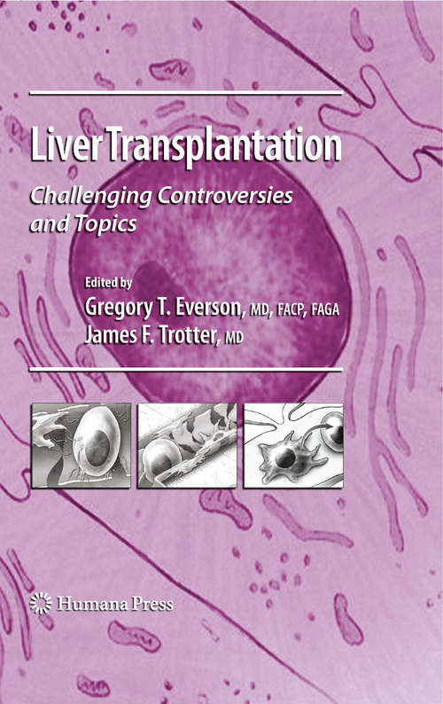 Book cover of Liver Transplantation: Challenging Controversies and Topics (2009) (Clinical Gastroenterology)