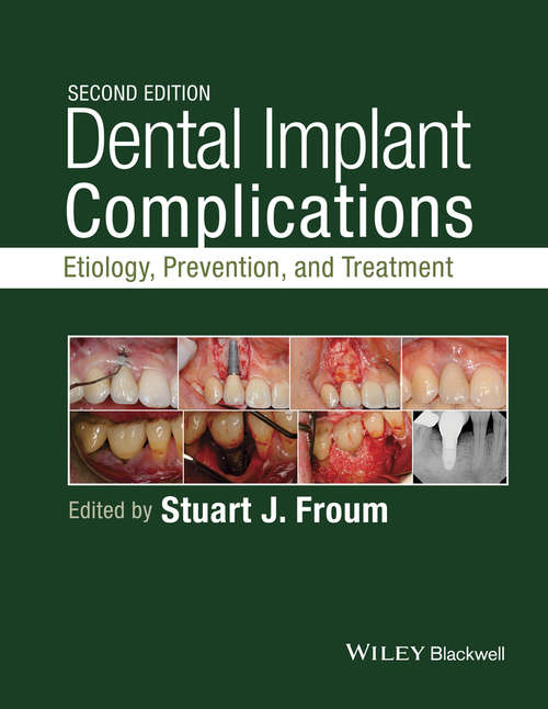 Book cover of Dental Implant Complications: Etiology, Prevention, and Treatment (2)