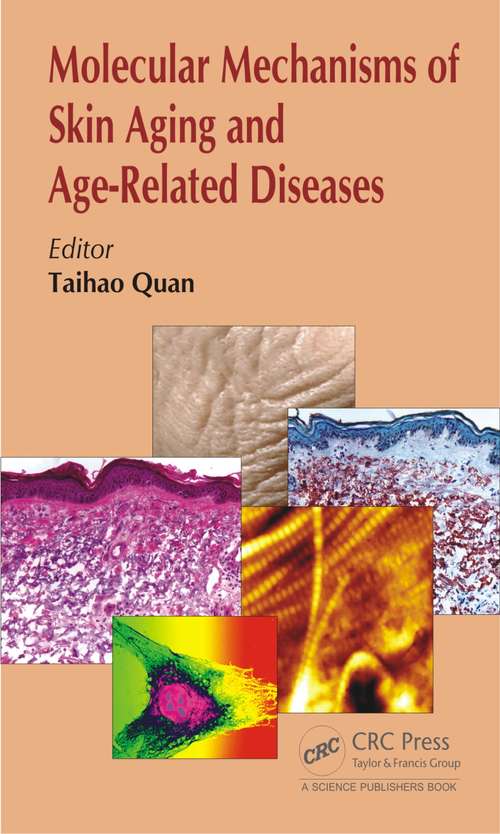 Book cover of Molecular Mechanisms of Skin Aging and Age-Related Diseases