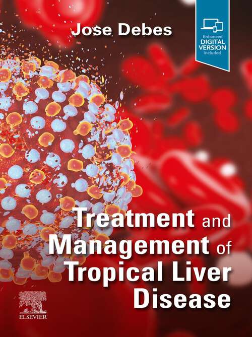 Book cover of Treatment and Management of Tropical Liver Disease
