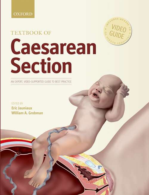 Book cover of Textbook of Caesarean Section