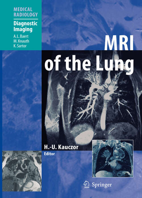 Book cover of MRI of the Lung (2nd rev. ed. 2009) (Medical Radiology)