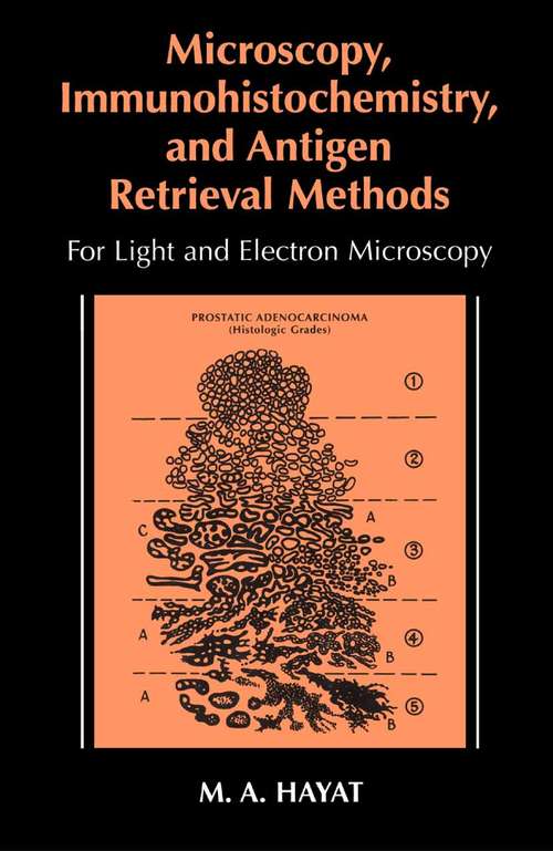 Book cover of Microscopy, Immunohistochemistry, and Antigen Retrieval Methods: For Light and Electron Microscopy (2002)