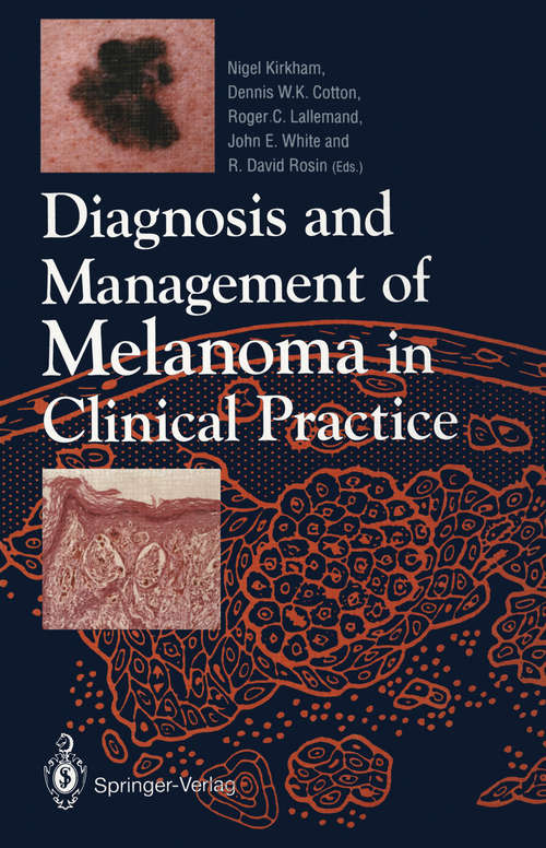 Book cover of Diagnosis and Management of Melanoma in Clinical Practice (1992)