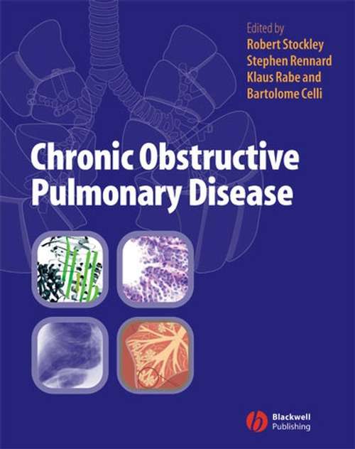 Book cover of Chronic Obstructive Pulmonary Disease