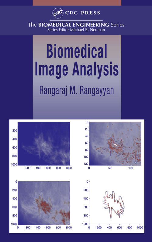 Book cover of Biomedical Image Analysis