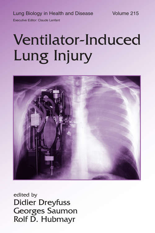 Book cover of Ventilator-Induced Lung Injury