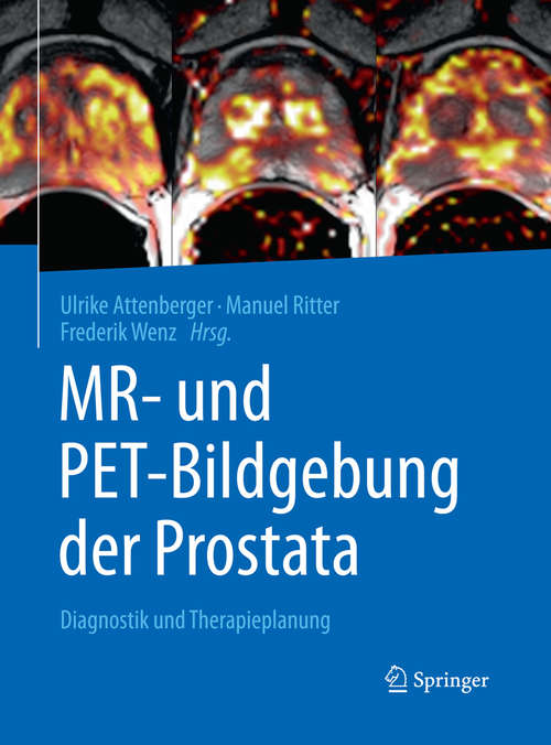 Book cover of MR- und PET-Bildgebung der Prostata: Diagnostik und Therapieplanung (1. Aufl. 2017)