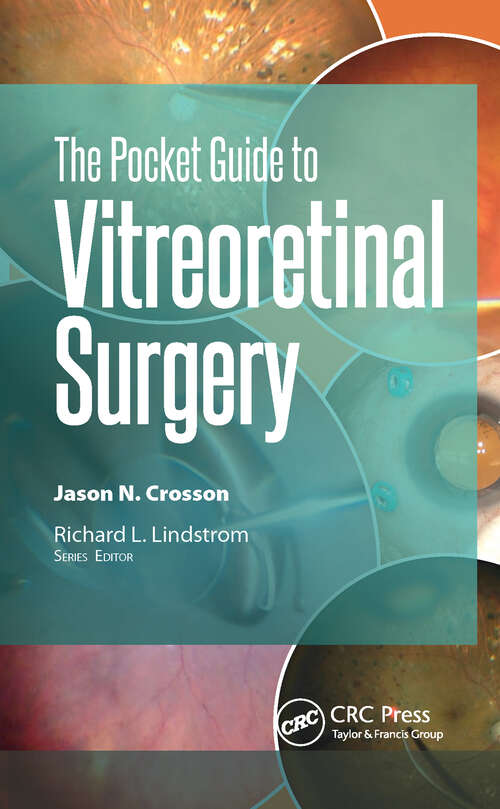 Book cover of The Pocket Guide to Vitreoretinal Surgery (Pocket Guides)