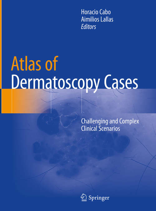 Book cover of Atlas of Dermatoscopy Cases: Challenging and Complex Clinical Scenarios (1st ed. 2020)