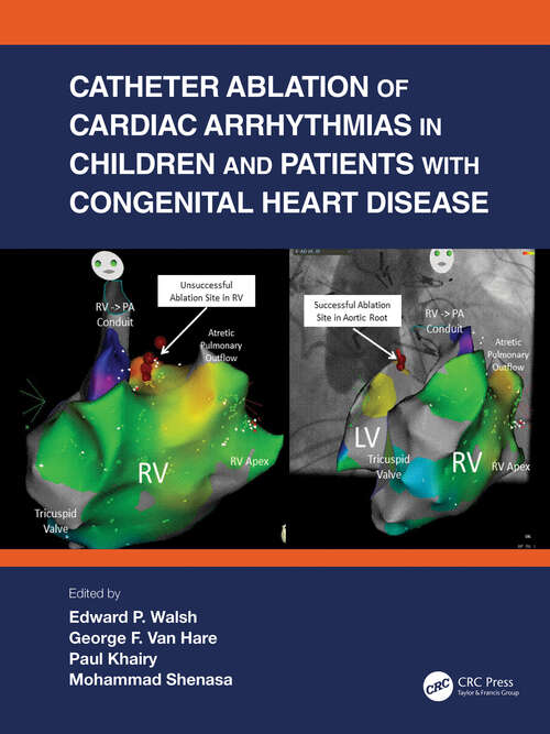 Book cover of Catheter Ablation of Cardiac Arrhythmias in Children and Patients with Congenital Heart Disease