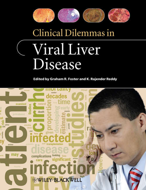 Book cover of Clinical Dilemmas in Viral Liver Disease