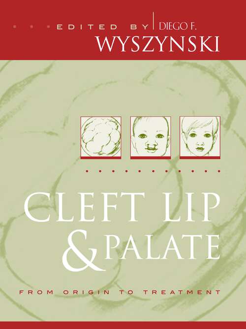 Book cover of Cleft Lip and Palate: From Origin to Treatment