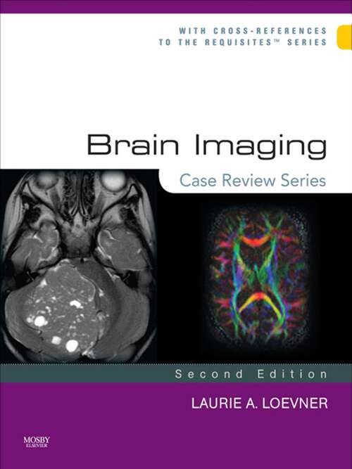 Book cover of Brain Imaging: Case Review Series E-Book (3) (Case Review)