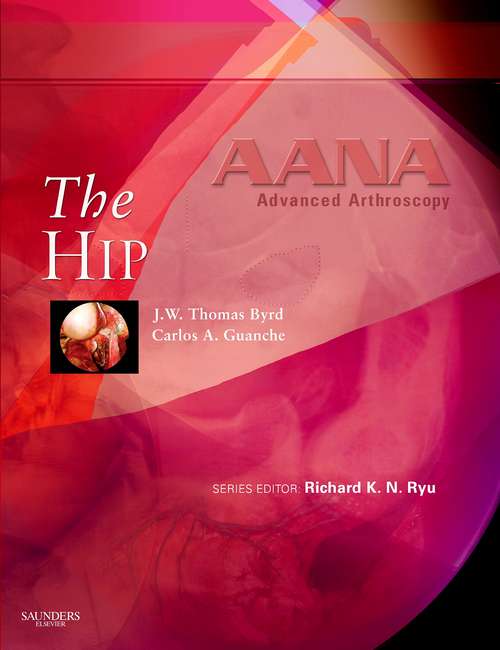 Book cover of AANA Advanced Arthroscopy: The Hip E-Book (AANA Advanced Arthroscopy)