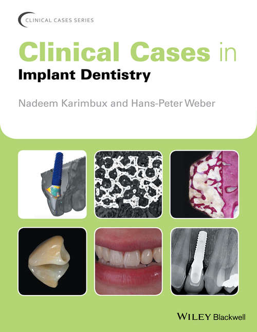 Book cover of Clinical Cases in Implant Dentistry (Clinical Cases (Dentistry))