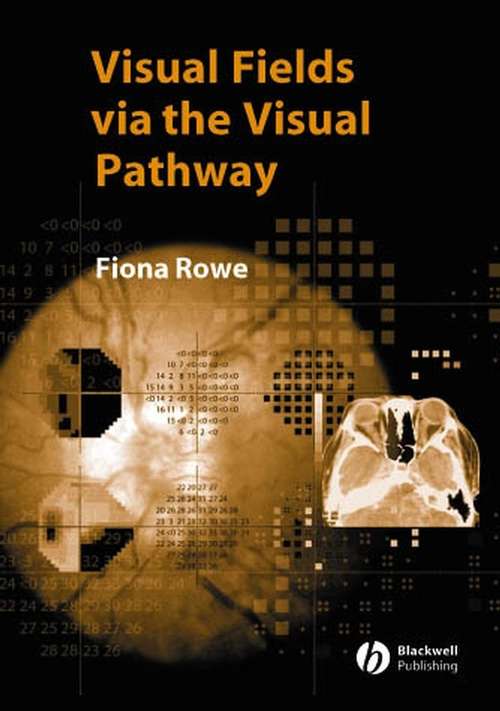 Book cover of Visual Fields via the Visual Pathway