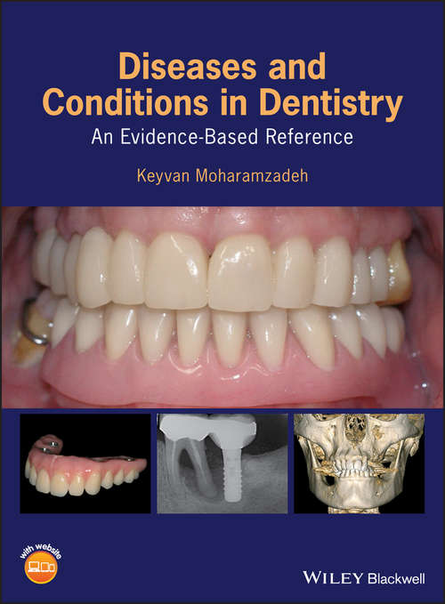 Book cover of Diseases and Conditions in Dentistry: An Evidence-Based Reference