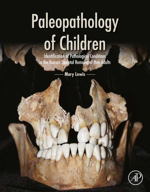 Book cover of Paleopathology of Children: Identification of Pathological Conditions in the Human Skeletal Remains of Non-Adults