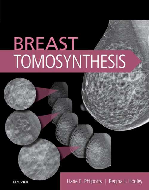 Book cover of Breast Tomosynthesis E-Book