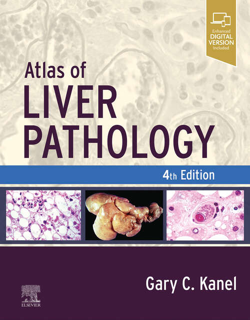 Book cover of Atlas of Liver Pathology - E-Book: Expert Consult - Online And Print (3) (Atlas of Surgical Pathology)