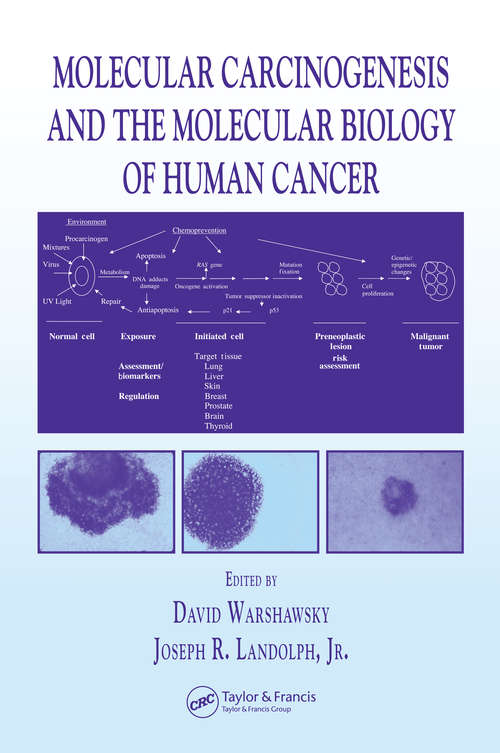 Book cover of Molecular Carcinogenesis and the Molecular Biology of Human Cancer