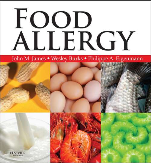 Book cover of Food Allergy E-Book: Expert Consult Basic