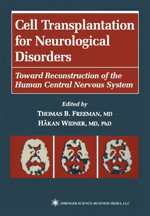 Book cover of Cell Transplantation for Neurological Disorders: Toward Reconstruction of the Human Central Nervous System (1998) (Contemporary Neuroscience)