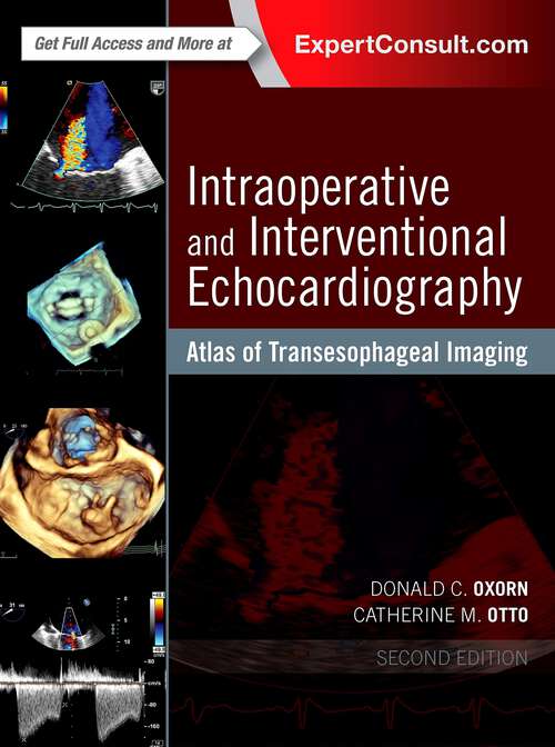 Book cover of Intraoperative and Interventional Echocardiography: Atlas of Transesophageal Imaging E-Book (2)