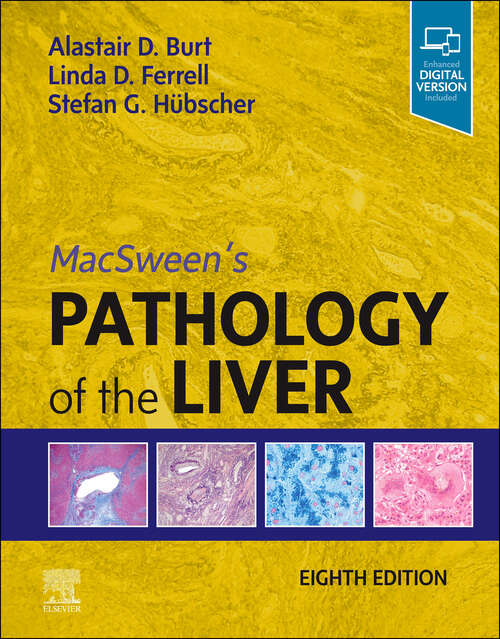 Book cover of MacSween's Pathology of the Liver, E-Book (8)