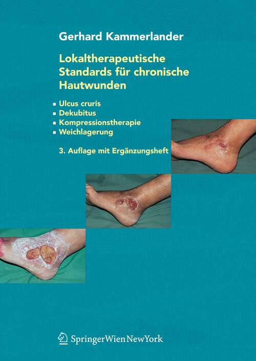 Book cover of Lokaltherapeutische Standards für chronische Hautwunden: Ulcus cruris - Dekubitus - Kompressionstherapie - Weichlagerung (3. Aufl. 2005)