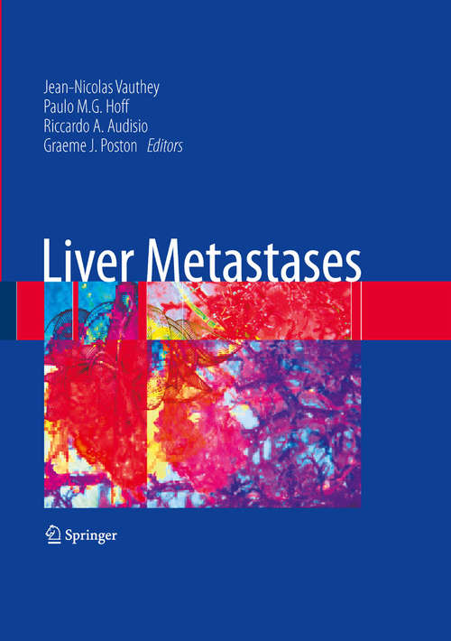 Book cover of Liver Metastases (2009)