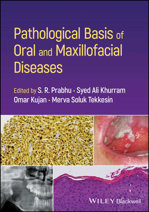 Book cover of Pathological Basis of Oral and Maxillofacial Diseases