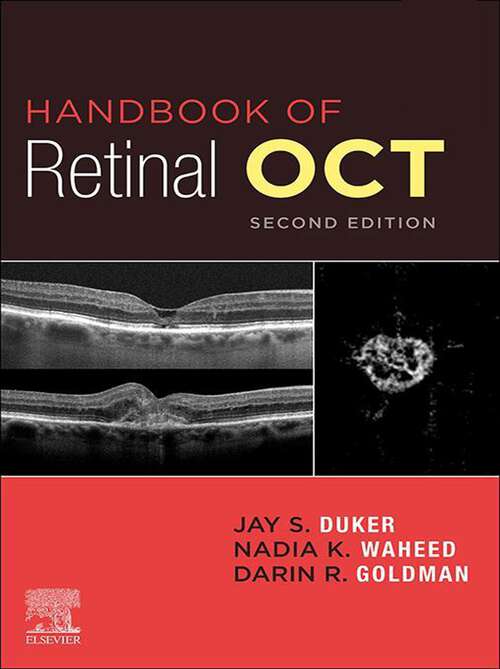 Book cover of Handbook of Retinal OCT: Optical Coherence Tomography (2)