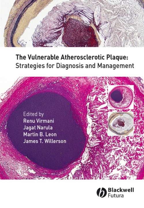Book cover of The Vulnerable Atherosclerotic Plaque: Strategies for Diagnosis and Management