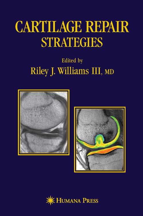 Book cover of Cartilage Repair Strategies (2007)