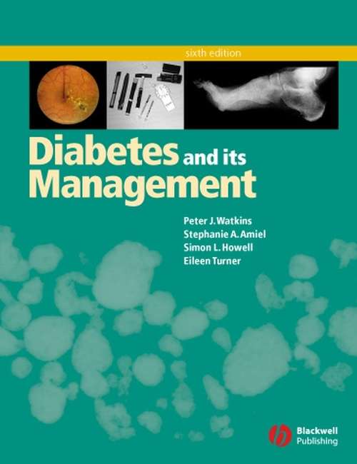 Book cover of Diabetes and Its Management (6)