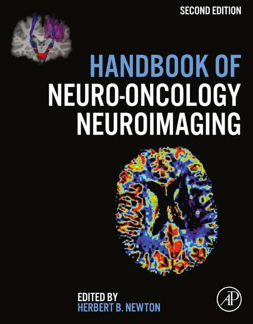 Book cover of Handbook of Neuro-Oncology Neuroimaging (2)